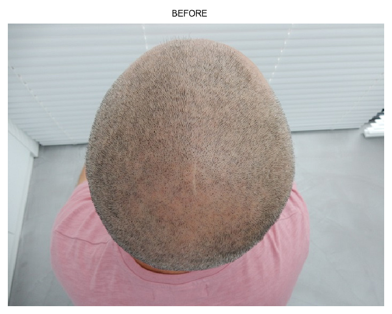 http://www.alopezie.de/fud/index.php/fa/19547/