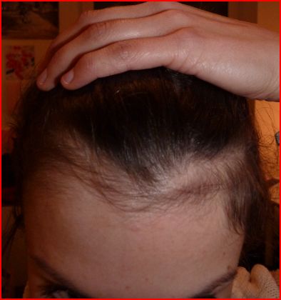 index.php/fa/1587/0/