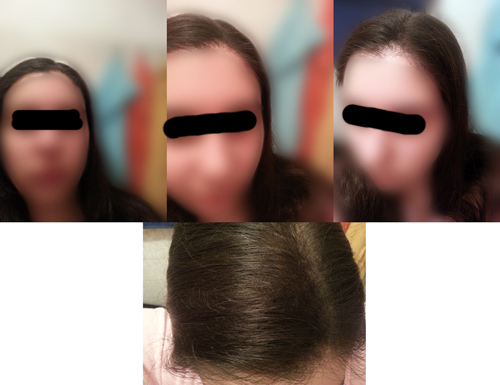 index.php/fa/1670/0/