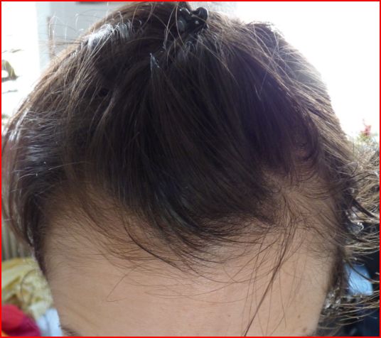 index.php/fa/1673/0/