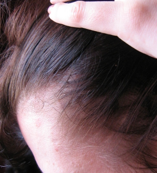 index.php/fa/2103/0/