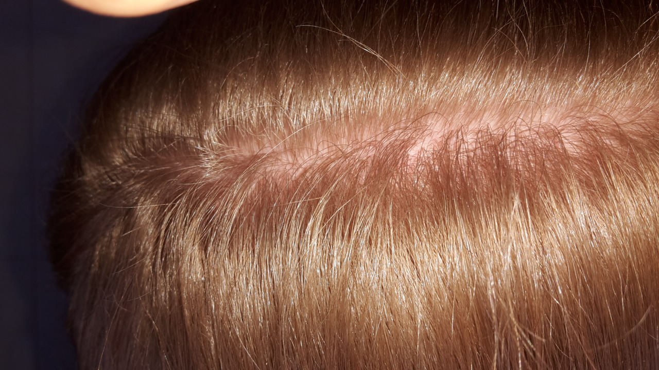 index.php/fa/2678/0/