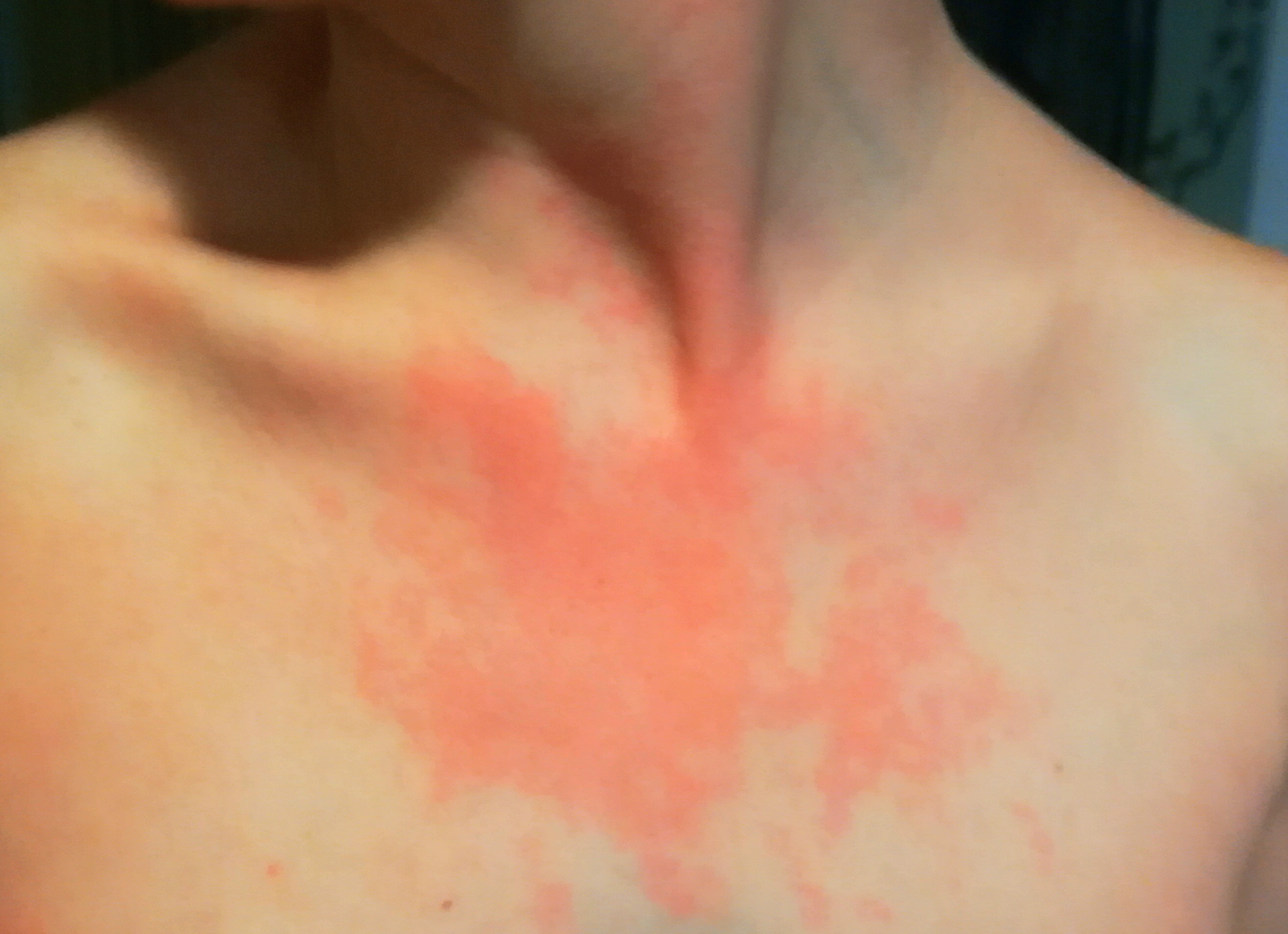 index.php/fa/2749/0/