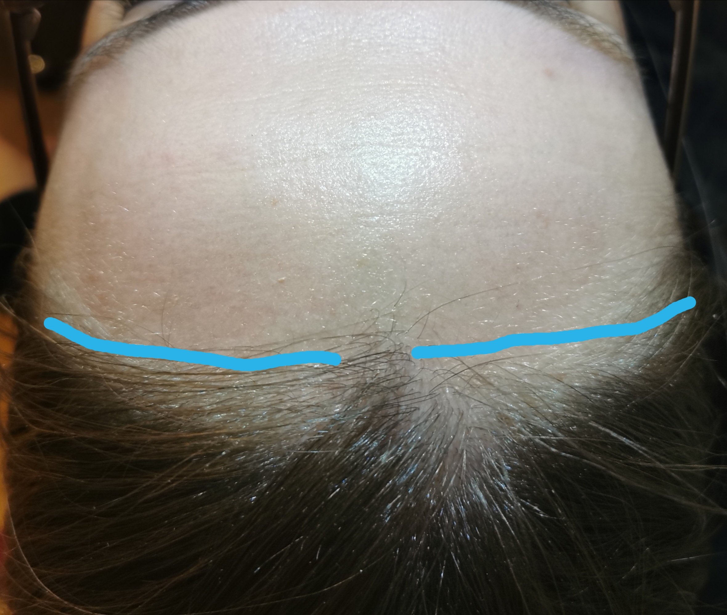 /foren/frauen/index.php/fa/2907/0/