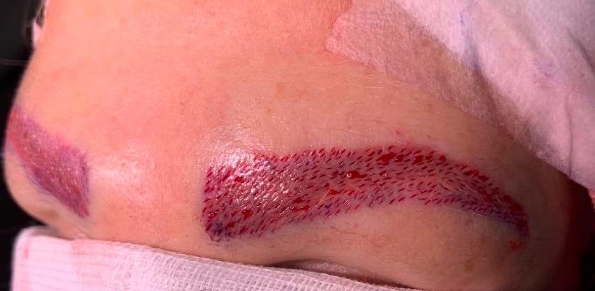 /foren/frauen/index.php/fa/2927/0/