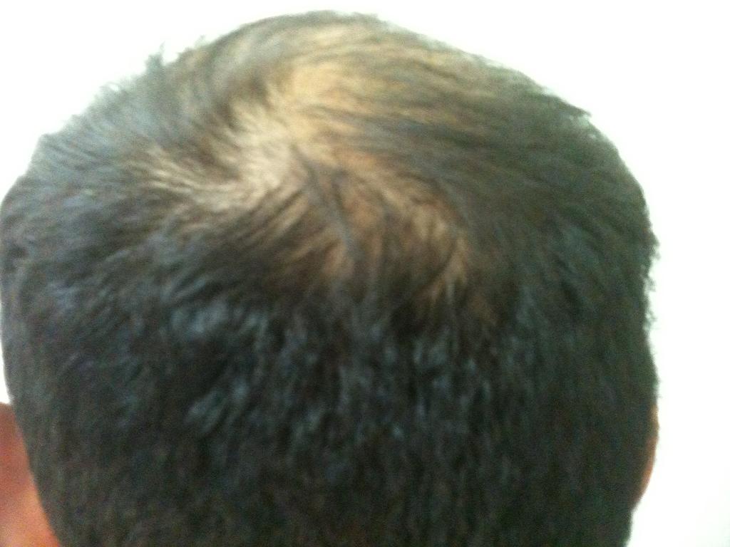 index.php/fa/10446/0/