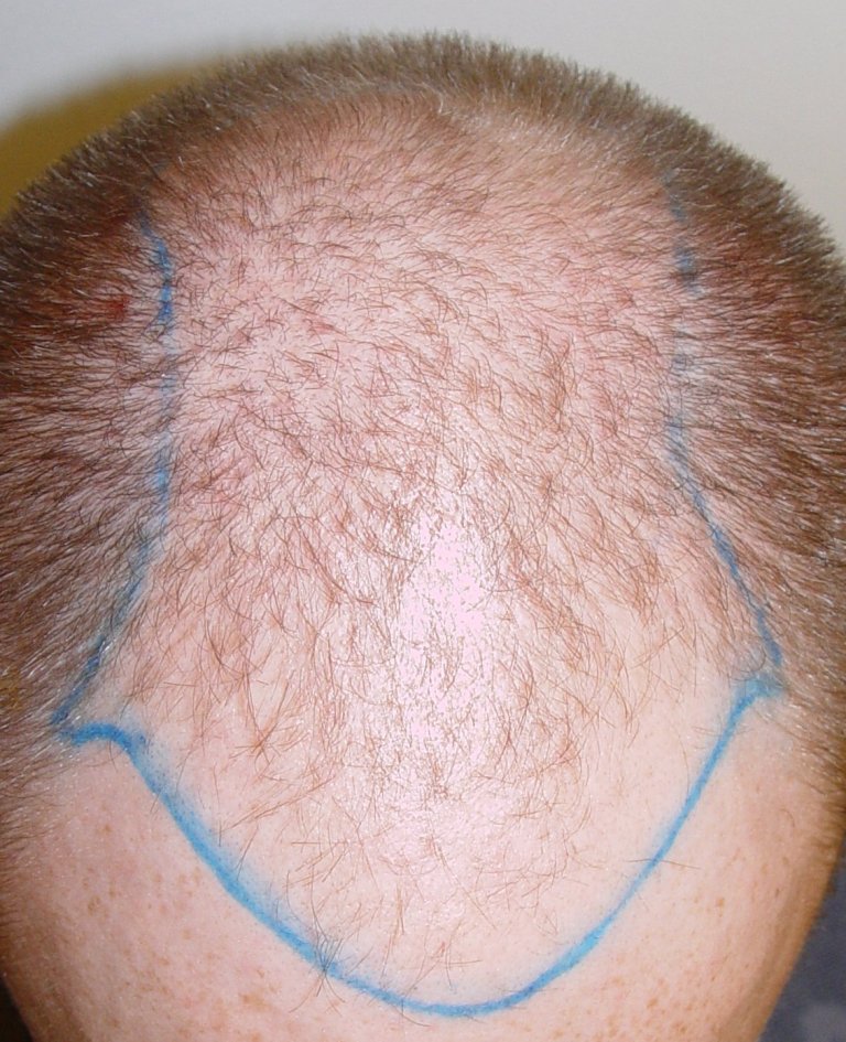 index.php/fa/1063/0/