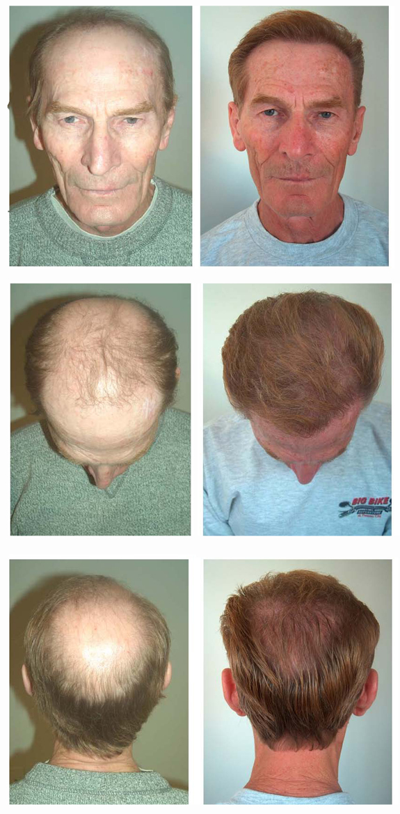 index.php/fa/10713/0/