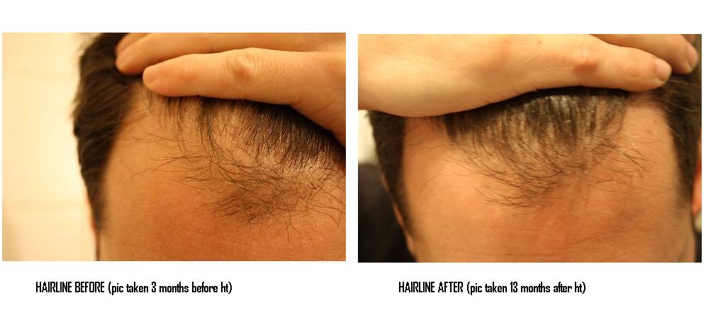 index.php/fa/10990/0/