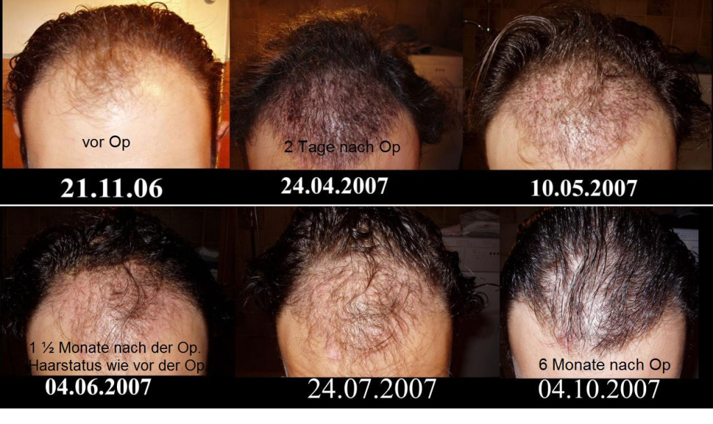 index.php/fa/1105/0/