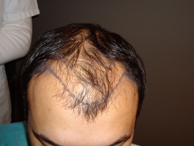 index.php/fa/11247/0/