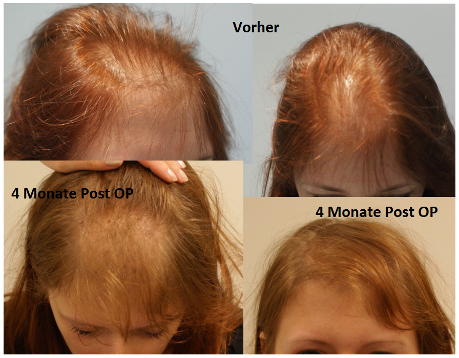 index.php/fa/11262/0/