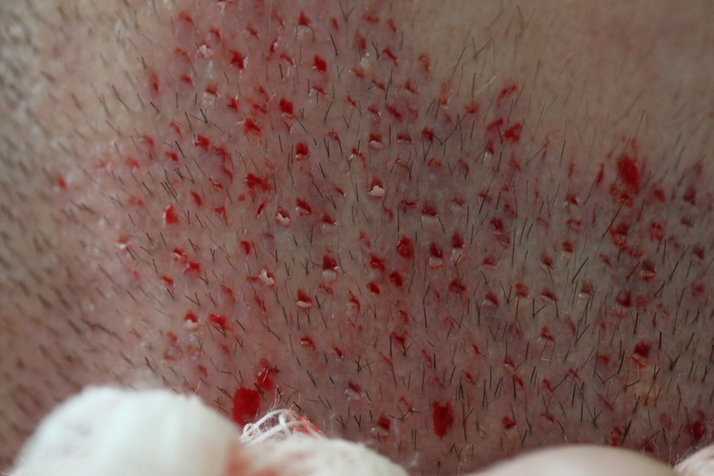 index.php/fa/11346/0/