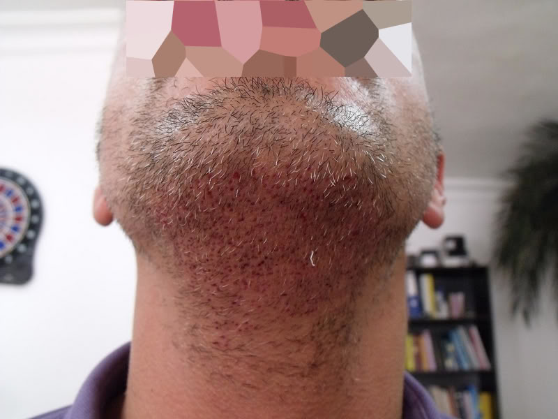 index.php/fa/11418/0/