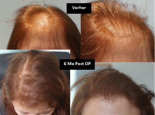 index.php/fa/11453/0/