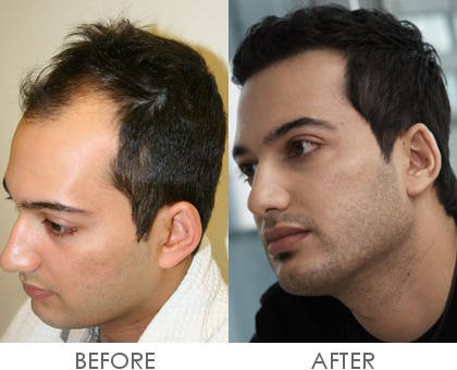 index.php/fa/11470/0/