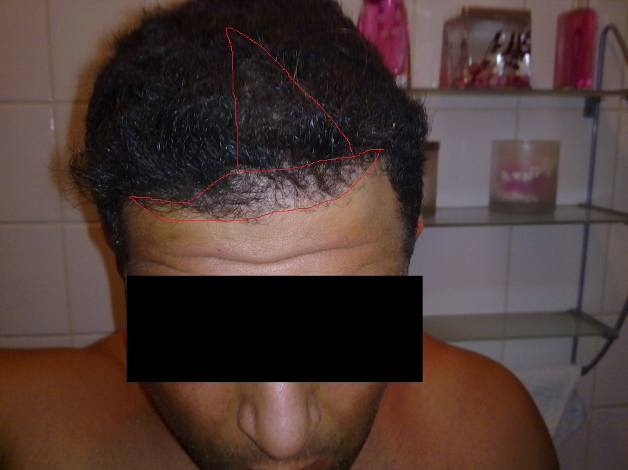 index.php/fa/11478/0/