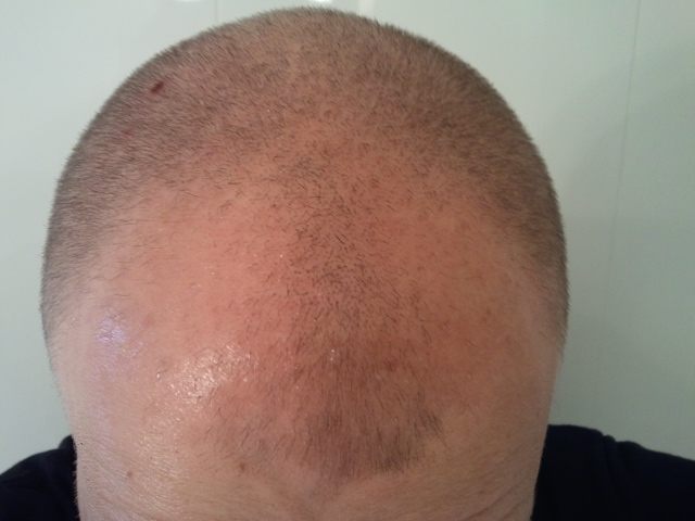 index.php/fa/11592/0/