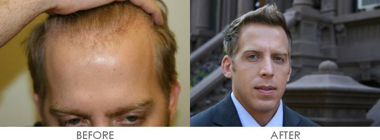 index.php/fa/11611/0/