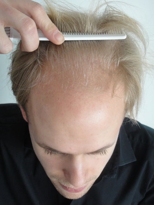 index.php/fa/11621/0/