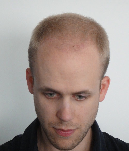 index.php/fa/11623/0/