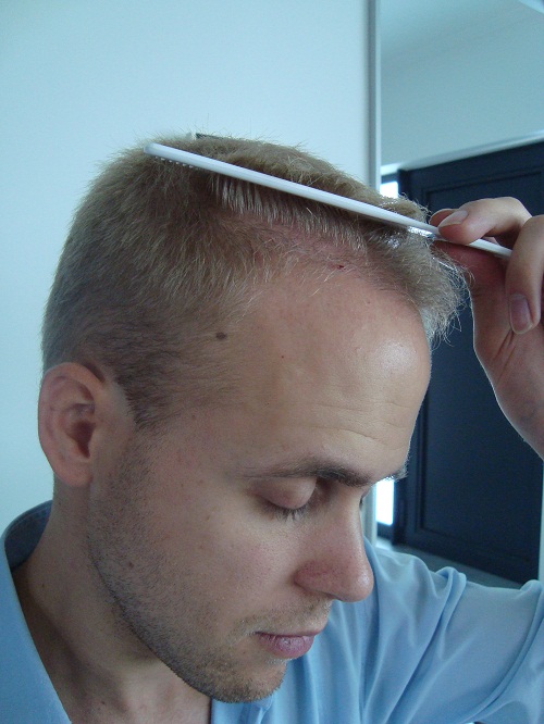 index.php/fa/11625/0/