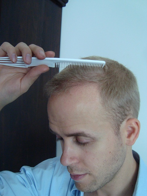 index.php/fa/11627/0/