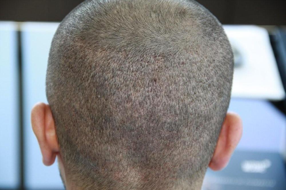 index.php/fa/11640/0/