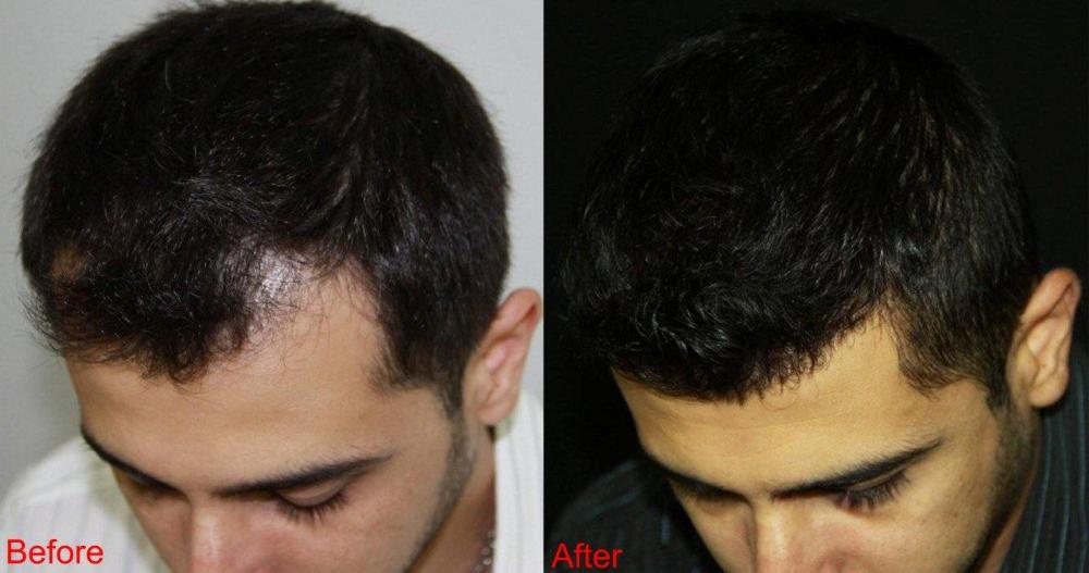 index.php/fa/11645/0/