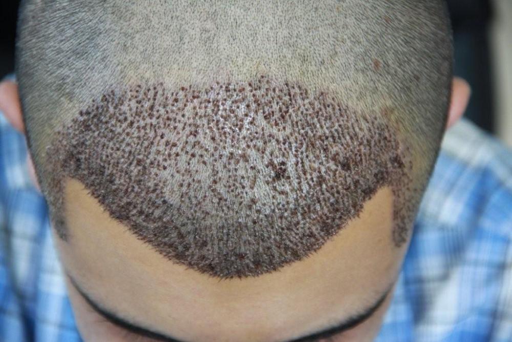 index.php/fa/11646/0/