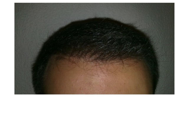 index.php/fa/11690/0/