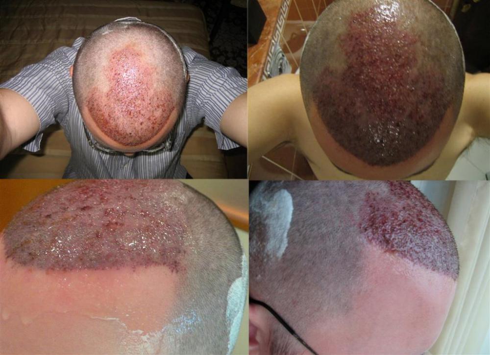 index.php/fa/11771/0/