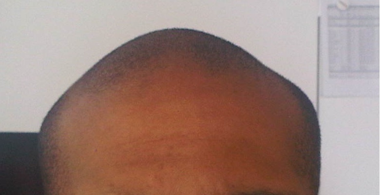 index.php/fa/11793/0/