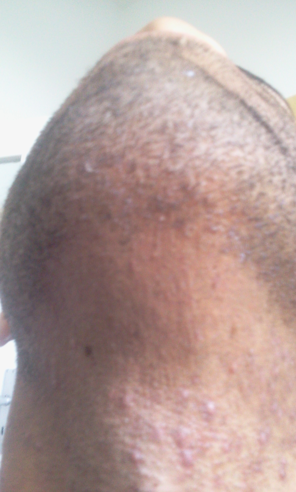 index.php/fa/11802/0/