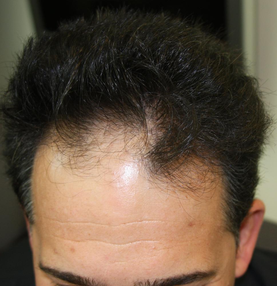 index.php/fa/11833/0/