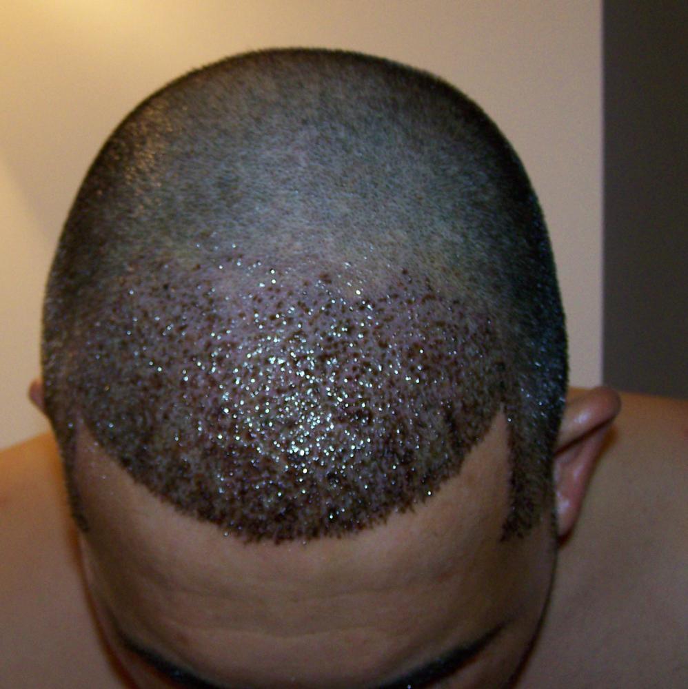 index.php/fa/11834/0/