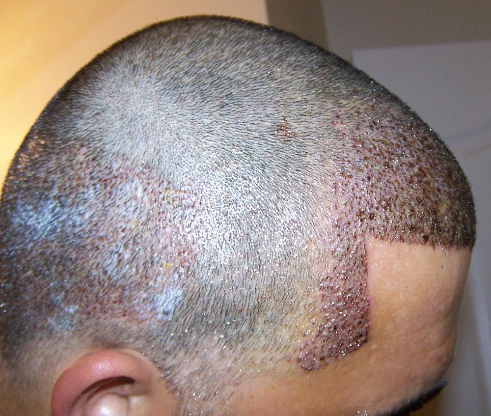 index.php/fa/11835/0/