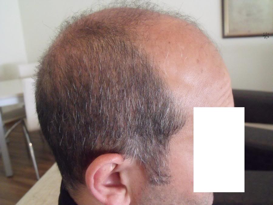 index.php/fa/11838/0/