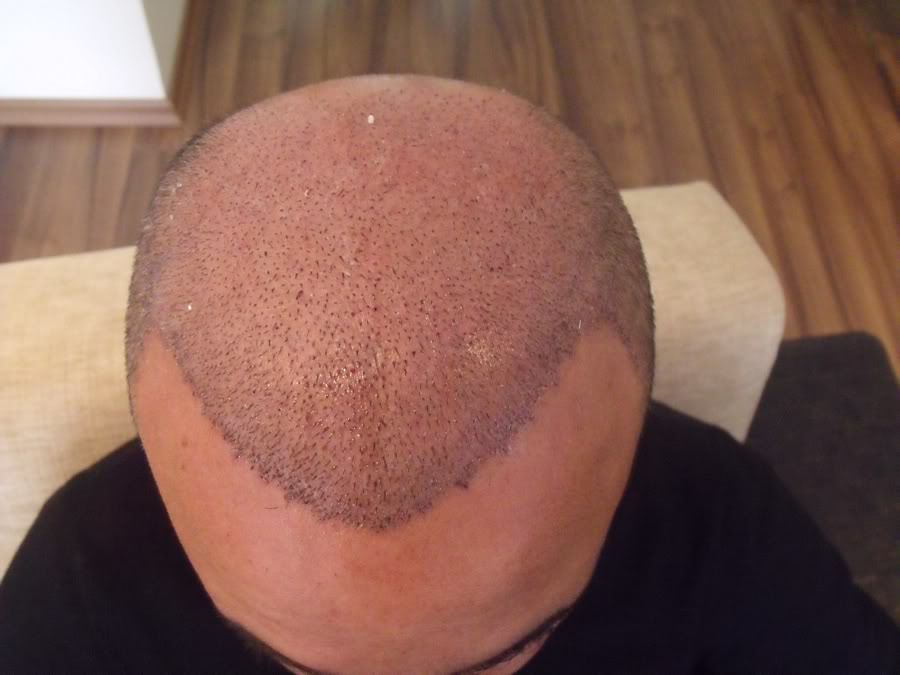 index.php/fa/11841/0/