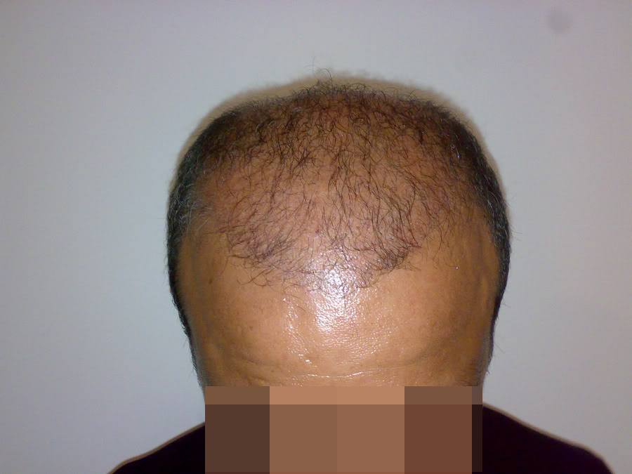 index.php/fa/11843/0/