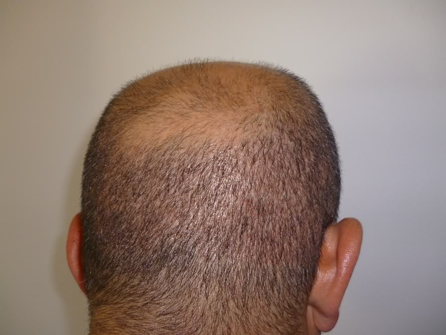 index.php/fa/11849/0/