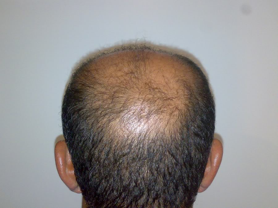 index.php/fa/11850/0/