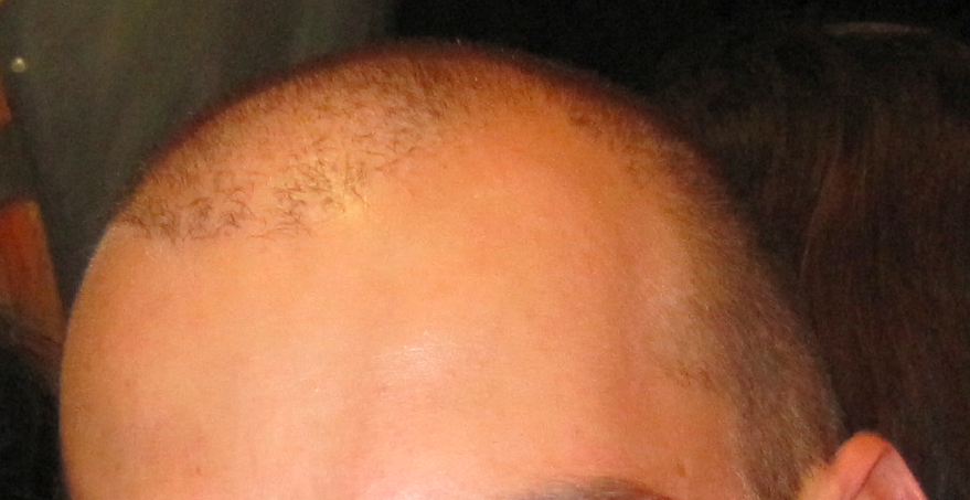 index.php/fa/11890/0/