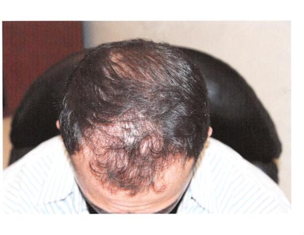 index.php/fa/11925/0/