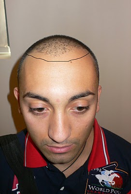 index.php/fa/11971/0/