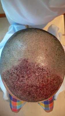 index.php/fa/11973/0/