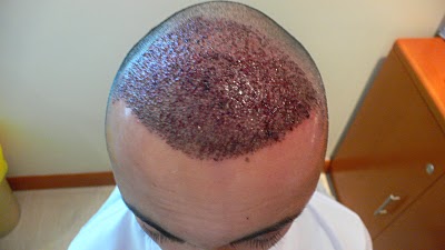 index.php/fa/11974/0/