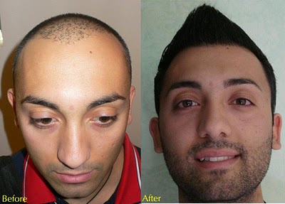 index.php/fa/11975/0/