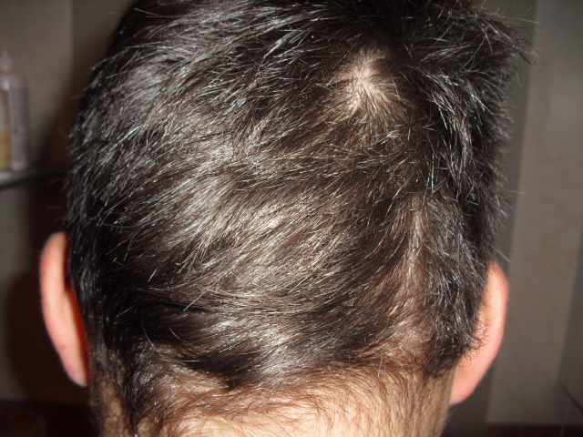 index.php/fa/12015/0/