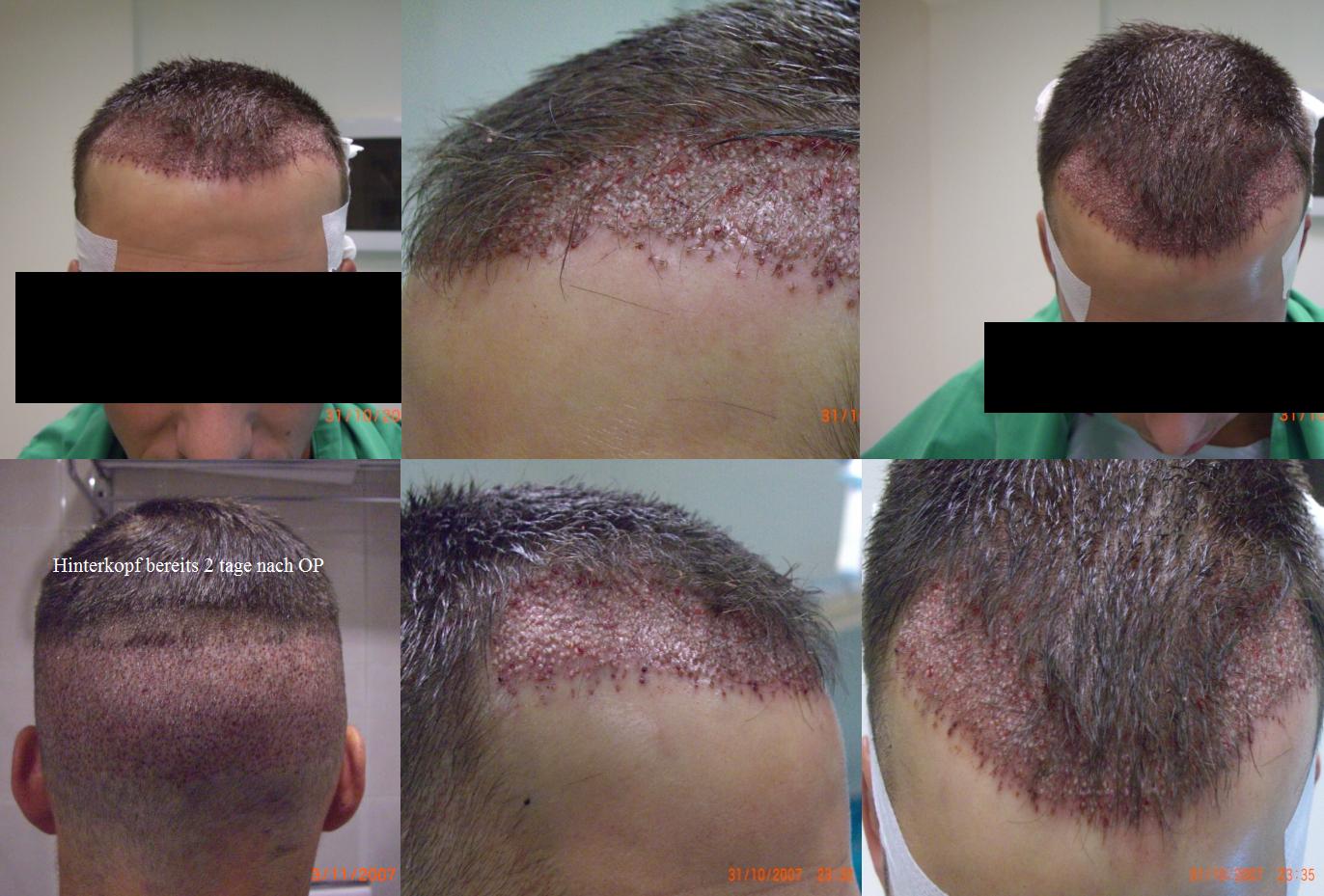 index.php/fa/1202/0/